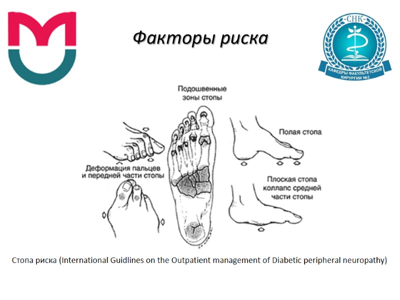 Факторы риска Стопа риска (International Guidlines on the Outpatient management of Diabetic peripheral neuropathy)